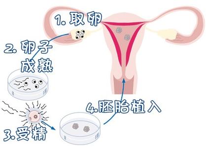 璟华生殖医学中心